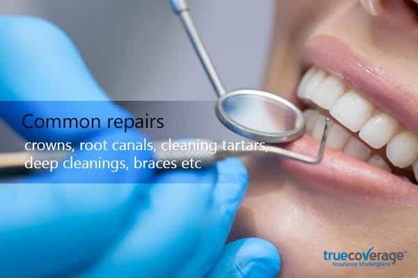 common repairs crown, root canals, cleaning tartars