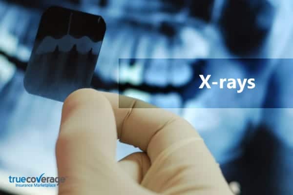 xrays