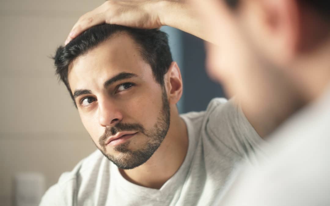 man worried for hair loss and looking at mirror his receding hairline.