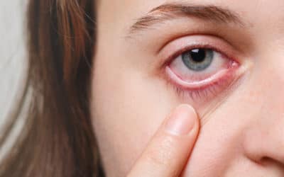 What you need to know about glaucoma